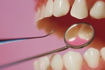 cure-dent et miroir étant utilisés sur les dents